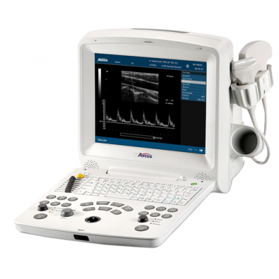 Digital Ultrasonic Diagnostic Imaging System, AV-60